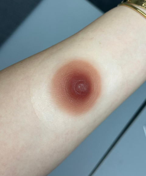 Redonnez forme et réalisme à votre poitrine grâce à nos prothèses d’aréoles en silicone 3D, sur mesure ou prêtes à porter, effet seconde peau garanti.